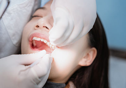 痛みや患者様に負担が少ない抜歯の実施